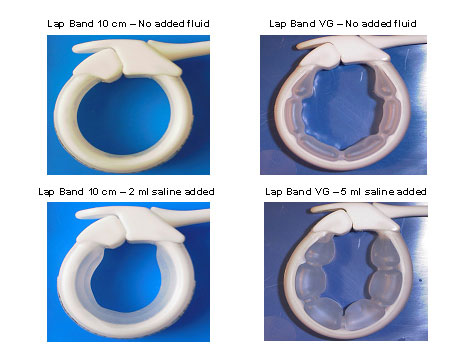 10 centimetre Vangard band